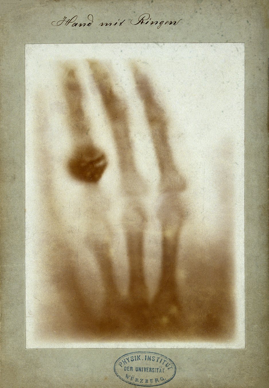 The first medical X-ray, showing Anna Bertha Röntgen’s hand and ring, made in 1895.